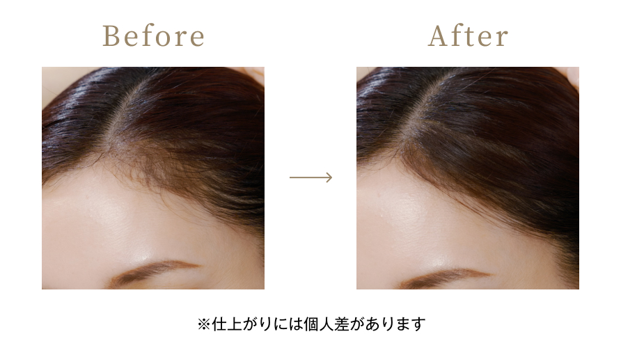 Before / After ※仕上がりには個人差があります